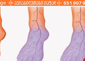 დიახ, თქვენ შეგიძლიათ გააუმჯობესოთ სისხლის ცუდი მიმოქცევა და მათ შორის აღმოფხვრათ “ცივი ფეხების” პრობლემა!!