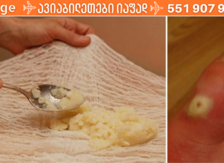 უსიამოვნო კოჟრები და ხორცმეტები, რომლებიც ხშირად გვიჩნდება კანზე სამუდამოდ გაქრება თუ ამ რეცეპტს გამოიყენებთ!