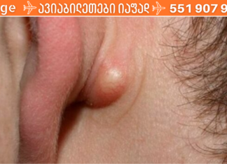 მოიშორეთ ცხიმოვანი კისტები ძალიან სწრაფად, მარტივად და ეფექტურად !