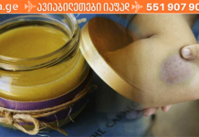 ეფექტური საშუალება, რომელიც სხეულიდან ძალიან სწრაფად მოგაშორებთ სილურჯეებს!