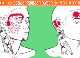 ვეღარ უძლებთ შაკიკით გამოწვეულ ტკივილებს? გაეცანით სტატიას აი რა უნდა მოიმოქმედოთ ამ დროს!