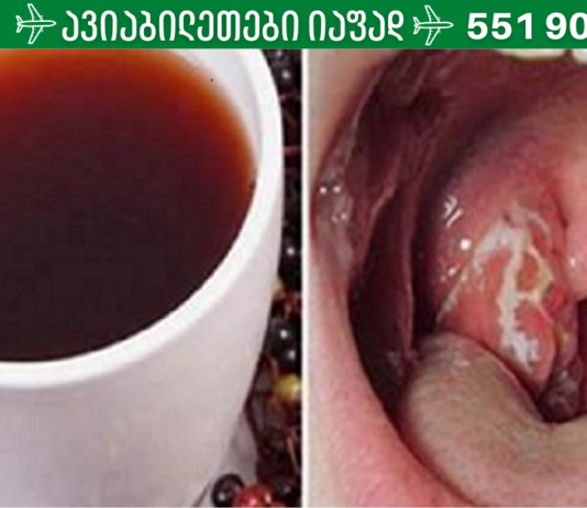 მოიშორეთ ყელის ყელანაირი სახის ინფექციები ამ ბუნებრივი საშუალებით, სულ რაღაც 4 საათში!!
