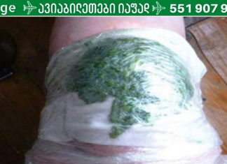 მან კომბოსტო მუხლზე დაიდო მთელი ღამით, ერთი თვის შემდეგ კი, ასეც მოხდა! წარმოუდგენელია!