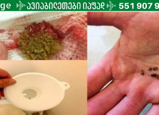 თირკმლებიდან კენჭების გამოდევნას ამ სახლის სამკურნალო საშუალების გამოყენებით შეძლებთ!