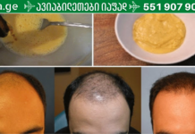 მან ბანანი და ლუდი წაისვა თმაზე – შედეგი კი 7 დღეში უკვე თვალსაჩინო იყო… წარმოუდგენელია!