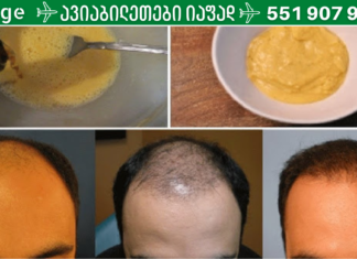 მან ბანანი და ლუდი წაისვა თმაზე – შედეგი კი 7 დღეში უკვე თვალსაჩინო იყო… წარმოუდგენელია!