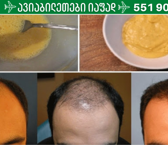 მან ბანანი და ლუდი წაისვა თმაზე – შედეგი კი 7 დღეში უკვე თვალსაჩინო იყო… წარმოუდგენელია!