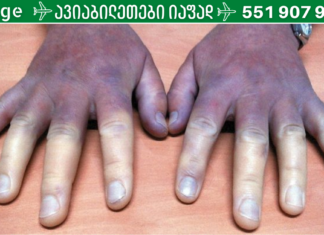 გაფრთხილება: თუ ხელები მუდმივად ცივი გაქვთ, შესაძლოა თქვენს ჯანმრთელობას სერიოზული საფრთხე ემუქრება.