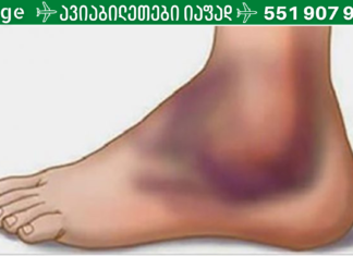 თუ თქვენი სხეული შეშუპებულია, ეს შეიძლება პროგრესული დაავადების ნიშანი იყოს!