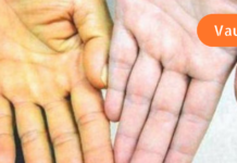 მოზარდი ყოველდღე სვამდა 3 ფინჯან მწვანე ჩაის. მომხდარმა ექიმები შოკში ჩააგდო