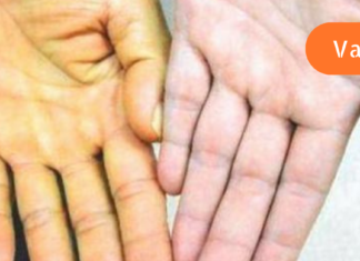 მოზარდი ყოველდღე სვამდა 3 ფინჯან მწვანე ჩაის. მომხდარმა ექიმები შოკში ჩააგდო