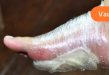 დაიმაგრეთ დაჭრილი ხახვი ფეხზე მთელი ღამით და ის დაგეხმარებათ თქვენი დაავადებების განკურნებაში – აი, რატომ!