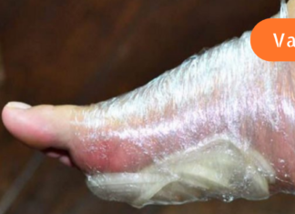 დაიმაგრეთ დაჭრილი ხახვი ფეხზე მთელი ღამით და ის დაგეხმარებათ თქვენი დაავადებების განკურნებაში – აი, რატომ!