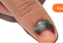 არასოდეს არ აურიოთ ეს დანამატები ერთმანეთს!