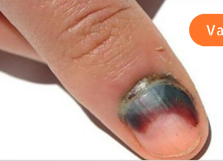 არასოდეს არ აურიოთ ეს დანამატები ერთმანეთს!