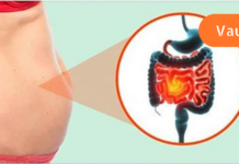 როგორ გავაუმჯობესოთ თქვენი ნაწლავის ბაქტერიები და დავიწყოთ წონის კლება!