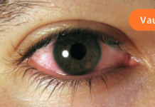 გაფრთხილება, ამ ჩვევას შეუძლია გამოიწვიოს სიბრმავე, ტიპი 2 დიაბეტი, სიმსუქნე, გულის დაავადება და სუსტი იმუნიტეტი!