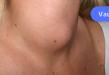 სწრაფი და მარტივი საშუალება ფარისებრი ჯირკვლის პრობლემების მოსაშორებლად!