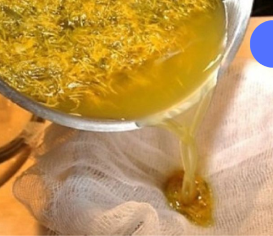 თუ თქვენც აღგენიშნებათ სისხლდენა სწორი ნაწლავიდან, იცოდეთ რომ ეს ბუასილია! მის სამკურნალოდ უნდა გამოიყენოთ ეს ნაყენი. .