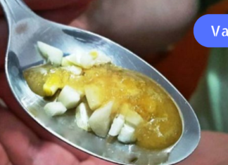 გაგანიერებული ვენების წინააღმდეგ გთავაზობთ ხალხური მედიცინის გასაოცარ რეცეპტებს!! რომლებიც საკუთარი გამოცდილებით ყველაზე კარგი შედეგის მქონეა