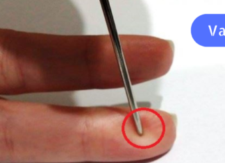 როგორ გადავარჩინოთ სიცოცხლე ინსულტის დროს მხოლოდ ნემსის გამოყენებით?