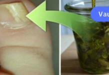 ფრჩხილის სოკო: მოიშორეთ ორეგანოს გამოყენებით, Როგორ გავაკეთო ეს?! აი რეცეპტიც