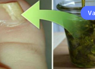 ფრჩხილის სოკო: მოიშორეთ ორეგანოს გამოყენებით, Როგორ გავაკეთო ეს?! აი რეცეპტიც