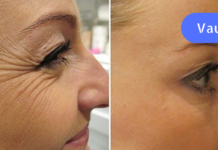 სასწაული საშუალებები, რომლებიც ამცირებს სიბერის თანმდევ პროცესს- ნაოჭებს!!