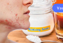 გამოიყენეთ ვაშლის ძმარი და საცხობი სოდა აკნეს მოსაშორებლად!