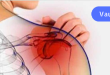 თუ თქვენც ჩემსავით გტკივათ მხრები და გიჭირთ ხელების მაღლა აწევა, გასწავლით მისი მკურნალობის ბუნებრივ მეთოდს!!