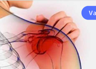 თუ თქვენც ჩემსავით გტკივათ მხრები და გიჭირთ ხელების მაღლა აწევა, გასწავლით მისი მკურნალობის ბუნებრივ მეთოდს!!