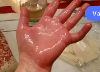 უკეთესია ვიდრე ტკივილგამაყუჩებლები: წაისვით ეს ზეთი ტკივილის მყისიერი შემსუბუქებისთვის! ართრიტის, რადიკულიტის ან ზურგის ტკივილის მქონე ადამიანებისთვის ეს საუკეთესო მეთოდია!