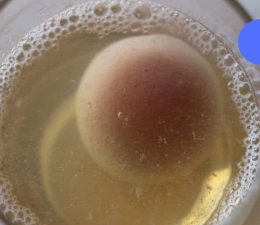 ეს საშუალებას მოაგვარებს ძვლებისა და სახსრების პრობლემებს, რომლებიც წლების განმავლობაში გქონდათ!