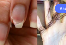 თუ თმა გამუდმებით გცვივათ და ფრჩხილები მტვრევადი გაქვთ, მაშინ მიირთვით ეს საკვები და ყველაფერი მალევე მოგვარდება!