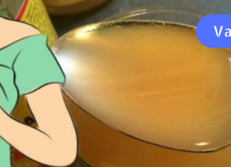 ვაშლის ძმრის გამოყენების 20 გასაოცარი გზა თქვენი სხეულისა და სახლის სისუფთავისთვის!