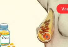 ვიტამინი, რომელიც აორმაგებს ძუძუს სხვადასხვა დაავადების პრევენციის შანსებს!