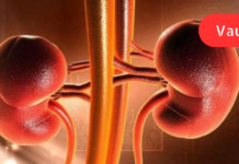 თირკმელების გაწმენდის 6 ბუნებრივი მეთოდი, რომლის შესახებაც უნდა იცოდეთ!