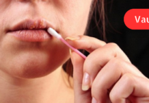 ჰერპესთან ბრძოლის ბუნებრივი გზები!