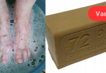 სარეცხის საპონი, როგორც ფეხების აუტანელ ტკივილთან ბრძოლის ერთ-ერთი საშუალება!