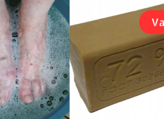 სარეცხის საპონი, როგორც ფეხების აუტანელ ტკივილთან ბრძოლის ერთ-ერთი საშუალება!