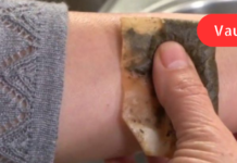 შეაჩერეთ სისხლდენა 10 წამში ამ გასაოცარი სანელებლის გამოყენებით!