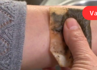 შეაჩერეთ სისხლდენა 10 წამში ამ გასაოცარი სანელებლის გამოყენებით!