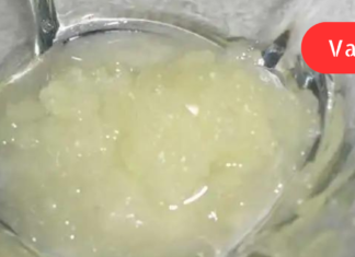 “ამ რეცეპტებს გიგზავნით მათთვის, ვინც თმის ცვენას და ქერტლს უჩივის”