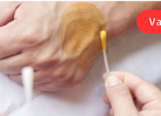 იოდის და ლიმონის ნარევი დაგეხმარებათ საკმაოდ რთული დაავადებების  განკურნებაში! თქვენ თავადვე გაეცანით მათ. .