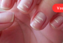 ეფექტური ხალხური რეცეპტები, რომლებიც თქვენს ორგანიზმს ვიტამინებით შეავსებს!