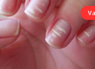 ეფექტური ხალხური რეცეპტები, რომლებიც თქვენს ორგანიზმს ვიტამინებით შეავსებს!