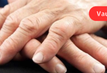 ართრიტის მკურნალობისას მარტო მედიკამენტები ვერაფერს გახდება! სცადეთ ეს ხალხური მეთოდებიც. .