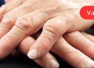 ართრიტის მკურნალობისას მარტო მედიკამენტები ვერაფერს გახდება! სცადეთ ეს ხალხური მეთოდებიც. .