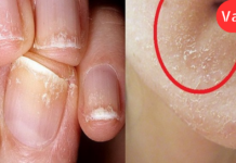 ალბათ ბევრს გასჩენია შეკითხვა რა სიმპტომების მატარებელია D ვიტამინის დეფიციტი ორგანიზმში, ამ სტატიაში კი სწორედაც, რომ ყველა მათგანს დეტალურად განვიხილავთ. .