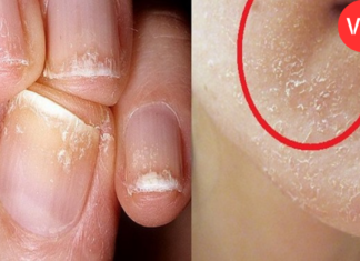 ალბათ ბევრს გასჩენია შეკითხვა რა სიმპტომების მატარებელია D ვიტამინის დეფიციტი ორგანიზმში, ამ სტატიაში კი სწორედაც, რომ ყველა მათგანს დეტალურად განვიხილავთ. .